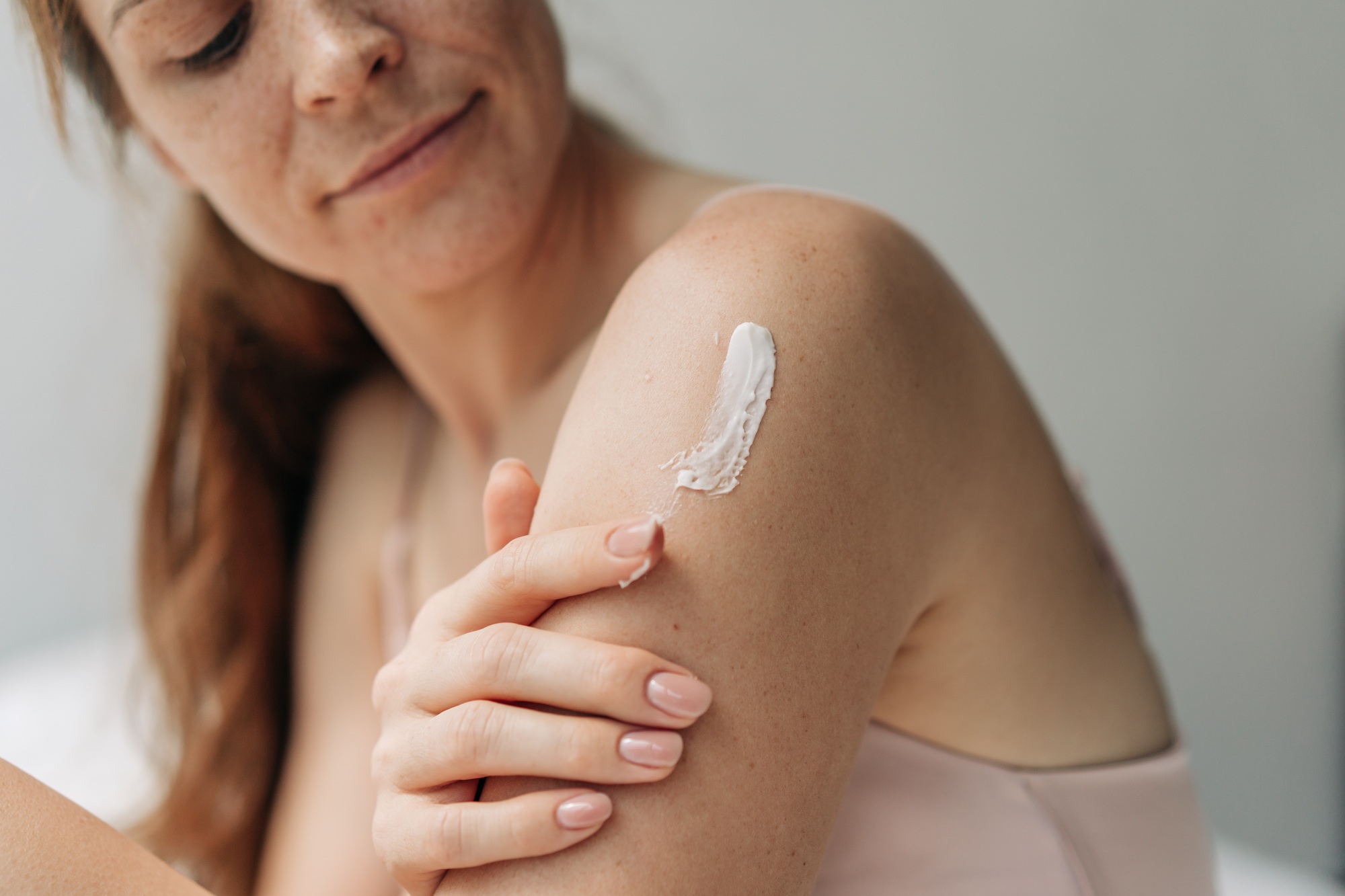 résultats avec Aldara crème